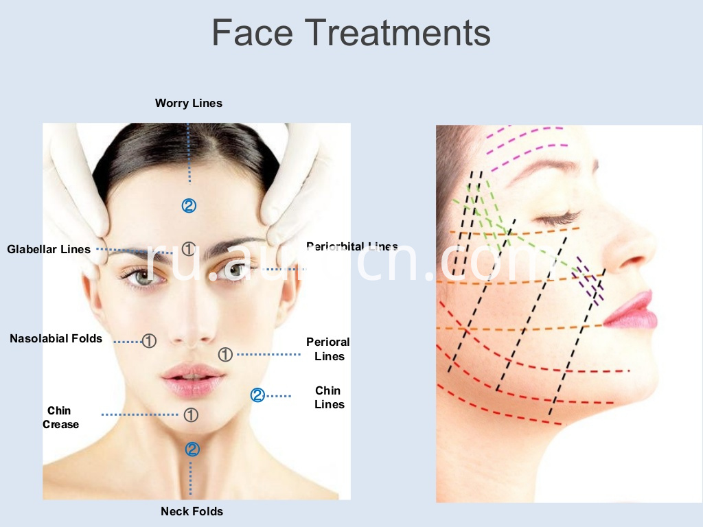 PDO-презентация Cog 3D Pdo Thread Lift Korea